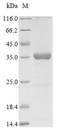 (Tris-Glycine gel) Discontinuous SDS-PAGE (reduced) with 5% enrichment gel and 15% separation gel.
