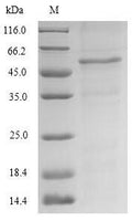 Recombinant Saccharomyces cerevisiae Protein GCY (GCY1) – Figure 1 of 1