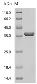 (Tris-Glycine gel) Discontinuous SDS-PAGE (reduced) with 5% enrichment gel and 15% separation gel.