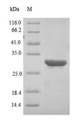 Recombinant Epstein-Barr virus Small capsomere-interacting protein (SCP), partial – Figure 1 of 1