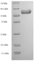 Recombinant Rabies virus Nucleoprotein (N) – Figure 1 of 1