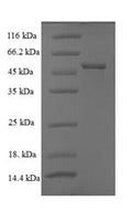 Recombinant Rotavirus A Intermediate capsid protein VP6 – Figure 1 of 1