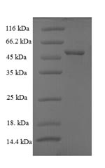 Recombinant Rotavirus A Intermediate capsid protein VP6 – Figure 1 of 1