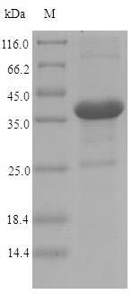 (Tris-Glycine gel) Discontinuous SDS-PAGE (reduced) with 5% enrichment gel and 15% separation gel.