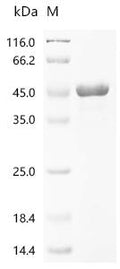 (Tris-Glycine gel) Discontinuous SDS-PAGE (reduced) with 5% enrichment gel and 15% separation gel.