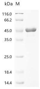 (Tris-Glycine gel) Discontinuous SDS-PAGE (reduced) with 5% enrichment gel and 15% separation gel.
