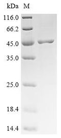 (Tris-Glycine gel) Discontinuous SDS-PAGE (reduced) with 5% enrichment gel and 15% separation gel.