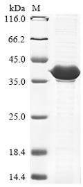 (Tris-Glycine gel) Discontinuous SDS-PAGE (reduced) with 5% enrichment gel and 15% separation gel.
