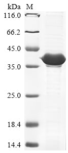 (Tris-Glycine gel) Discontinuous SDS-PAGE (reduced) with 5% enrichment gel and 15% separation gel.