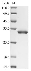 (Tris-Glycine gel) Discontinuous SDS-PAGE (reduced) with 5% enrichment gel and 15% separation gel.