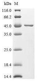 (Tris-Glycine gel) Discontinuous SDS-PAGE (reduced) with 5% enrichment gel and 15% separation gel.