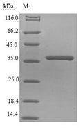 (Tris-Glycine gel) Discontinuous SDS-PAGE (reduced) with 5% enrichment gel and 15% separation gel.