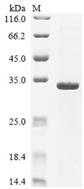 (Tris-Glycine gel) Discontinuous SDS-PAGE (reduced) with 5% enrichment gel and 15% separation gel.