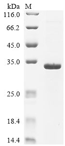 (Tris-Glycine gel) Discontinuous SDS-PAGE (reduced) with 5% enrichment gel and 15% separation gel.
