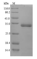 (Tris-Glycine gel) Discontinuous SDS-PAGE (reduced) with 5% enrichment gel and 15% separation gel.