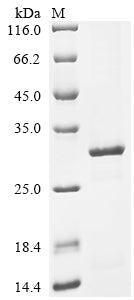 (Tris-Glycine gel) Discontinuous SDS-PAGE (reduced) with 5% enrichment gel and 15% separation gel.