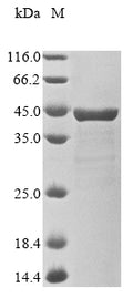 (Tris-Glycine gel) Discontinuous SDS-PAGE (reduced) with 5% enrichment gel and 15% separation gel.