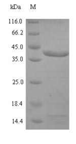 (Tris-Glycine gel) Discontinuous SDS-PAGE (reduced) with 5% enrichment gel and 15% separation gel.