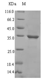 (Tris-Glycine gel) Discontinuous SDS-PAGE (reduced) with 5% enrichment gel and 15% separation gel.