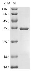 (Tris-Glycine gel) Discontinuous SDS-PAGE (reduced) with 5% enrichment gel and 15% separation gel.