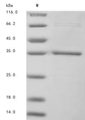 (Tris-Glycine gel) Discontinuous SDS-PAGE (reduced) with 5% enrichment gel and 15% separation gel.