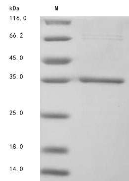 (Tris-Glycine gel) Discontinuous SDS-PAGE (reduced) with 5% enrichment gel and 15% separation gel.