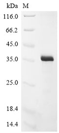(Tris-Glycine gel) Discontinuous SDS-PAGE (reduced) with 5% enrichment gel and 15% separation gel.