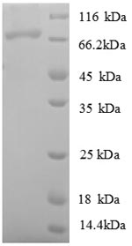 Recombinant Escherichia coli DNA ligase (ligA) – Figure 1 of 1