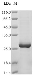 (Tris-Glycine gel) Discontinuous SDS-PAGE (reduced) with 5% enrichment gel and 15% separation gel.