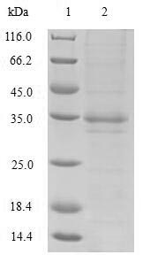 Recombinant Bordetella pertussis Serotype 3 fimbrial subunit (fim3) – Figure 1 of 1