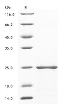 (Tris-Glycine gel) Discontinuous SDS-PAGE (reduced) with 5% enrichment gel and 15% separation gel.