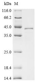 (Tris-Glycine gel) Discontinuous SDS-PAGE (reduced) with 5% enrichment gel and 15% separation gel.