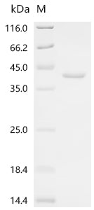(Tris-Glycine gel) Discontinuous SDS-PAGE (reduced) with 5% enrichment gel and 15% separation gel.