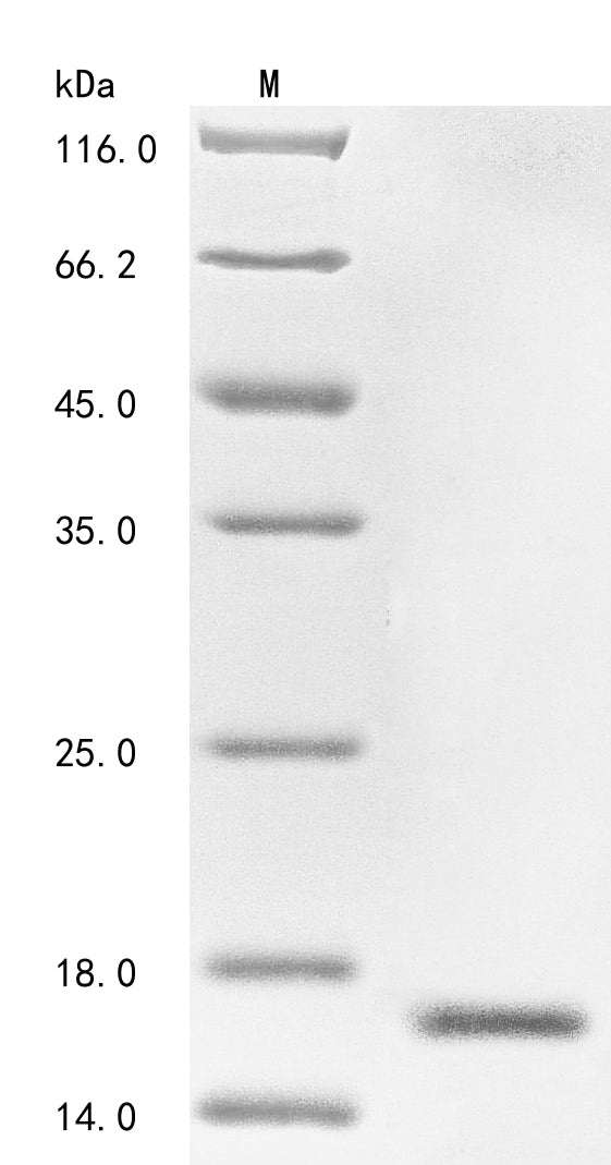 (Tris-Glycine gel) Discontinuous SDS-PAGE (reduced) with 5% enrichment gel and 15% separation gel.