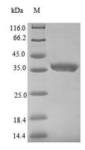 Recombinant Zaire ebolavirus Nucleoprotein (NP), partial – Figure 1 of 1
