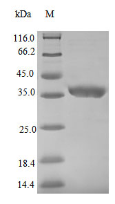 Recombinant Zaire ebolavirus Nucleoprotein (NP), partial – Figure 1 of 1