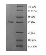 Recombinant Escherichia coli Plasmid-derived single-stranded DNA-binding protein (ssbF) – Figure 1 of 1