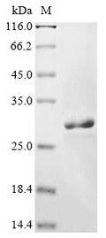 (Tris-Glycine gel) Discontinuous SDS-PAGE (reduced) with 5% enrichment gel and 15% separation gel.