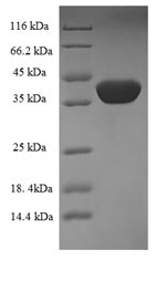 Recombinant Escherichia coli Oxygen-insensitive NADPH nitroreductase (nfsA) – Figure 1 of 1