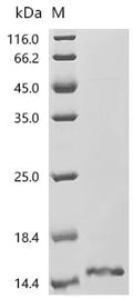 (Tris-Glycine gel) Discontinuous SDS-PAGE (reduced) with 5% enrichment gel and 15% separation gel.