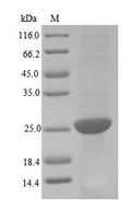 (Tris-Glycine gel) Discontinuous SDS-PAGE (reduced) with 5% enrichment gel and 15% separation gel.