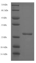 Recombinant Simian immunodeficiency virus Protein Vpx (vpx) – Figure 1 of 1