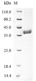 (Tris-Glycine gel) Discontinuous SDS-PAGE (reduced) with 5% enrichment gel and 15% separation gel.