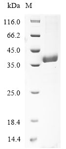 (Tris-Glycine gel) Discontinuous SDS-PAGE (reduced) with 5% enrichment gel and 15% separation gel.