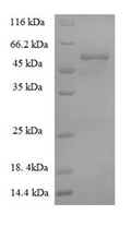 Recombinant African cassava mosaic virus Replication-associated protein (AC1) – Figure 1 of 1