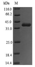 (Tris-Glycine gel) Discontinuous SDS-PAGE (reduced) with 5% enrichment gel and 15% separation gel.