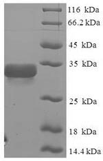Recombinant Glycine max 2S albumin – Figure 1 of 1