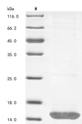 (Tris-Glycine gel) Discontinuous SDS-PAGE (reduced) with 5% enrichment gel and 15% separation gel.