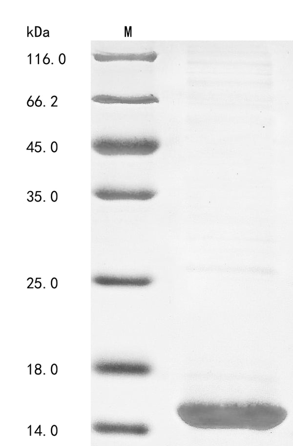 (Tris-Glycine gel) Discontinuous SDS-PAGE (reduced) with 5% enrichment gel and 15% separation gel.