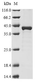 (Tris-Glycine gel) Discontinuous SDS-PAGE (reduced) with 5% enrichment gel and 15% separation gel.